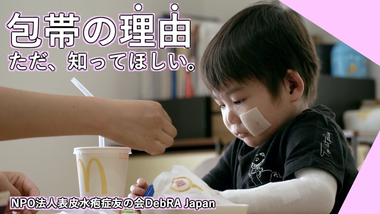 頬にガーゼを貼った子どもと「包帯の理由 ただ、知ってほしい。」の文字
